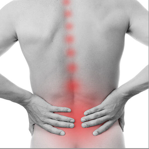 Physical Therapy for Back Injury